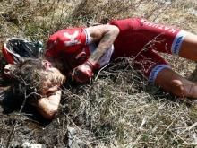 Кроме ключицы, велогонщик Ильнур Закарин сломал в горах Италии еще и лопатку