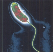 В водоёмах Набережных Челнов обнаружены холероподобные вибрионы